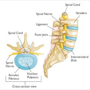Sciatic Nerve Injury Treatment - Chiropractor, Tampa: Low Back Pain And Sciatica.