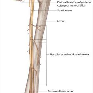 Exercises For Sciatic Nerve Injury - 3 Questions On Sciatica - Do You Know The "Right" Answers?