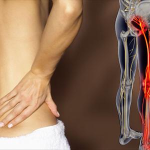 Natural Remedies For Sciatica - Information On Sciatica And Causes