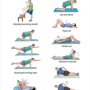 Sciatica Exercises To Relieve Pain - The Best & Quickest Exercise To Relieve Sciatica