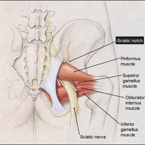 Exercises To Relieve Sciatica Pain - The Best & Quickest Exercise To Relieve Sciatica