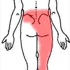 Back Sciatica - Best Natural Treatments Of Sciatica