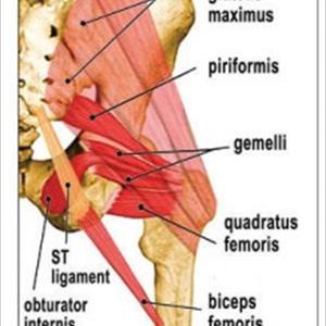 Sciatica And The Wallet - Demystifying Sciatica