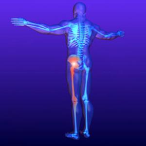 Sciatica Nerve Damage - Sciatica - Discover These 5 Amazing Tips And Be Pain Free Now!
